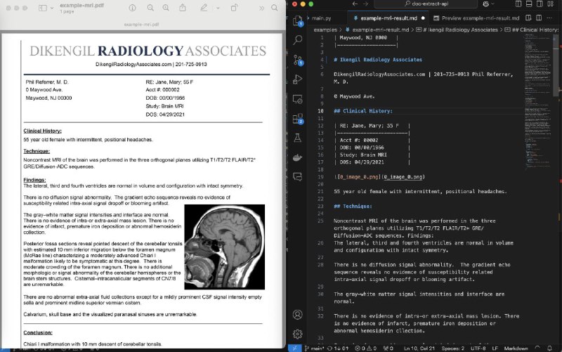 #GitHub #OCR #API📁 pdf-extract-api - 高精度文档解析和提取 API▎项目功能：文档解析和提取▎项目介绍：一个文档解析和提取 API，支持将 PDF 或图片文件转换为结构化的 JSON 或 Markdown 格式
